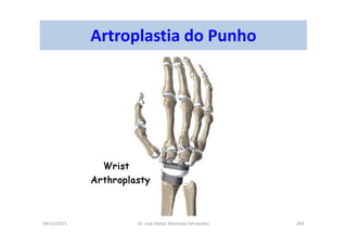 09/12/2015 Dr. José Heitor Machado Fernandes 284
Artroplastia do Punho
 