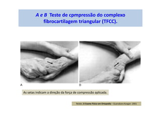 A e B Teste de cpmpressão do complexo
fibrocartilagem triangular (TFCC).
As setas indicam a direção da força de compressão aplicada.
Reider, O Exame Físico em Ortopedia – Guanabara Koogan -2001
 