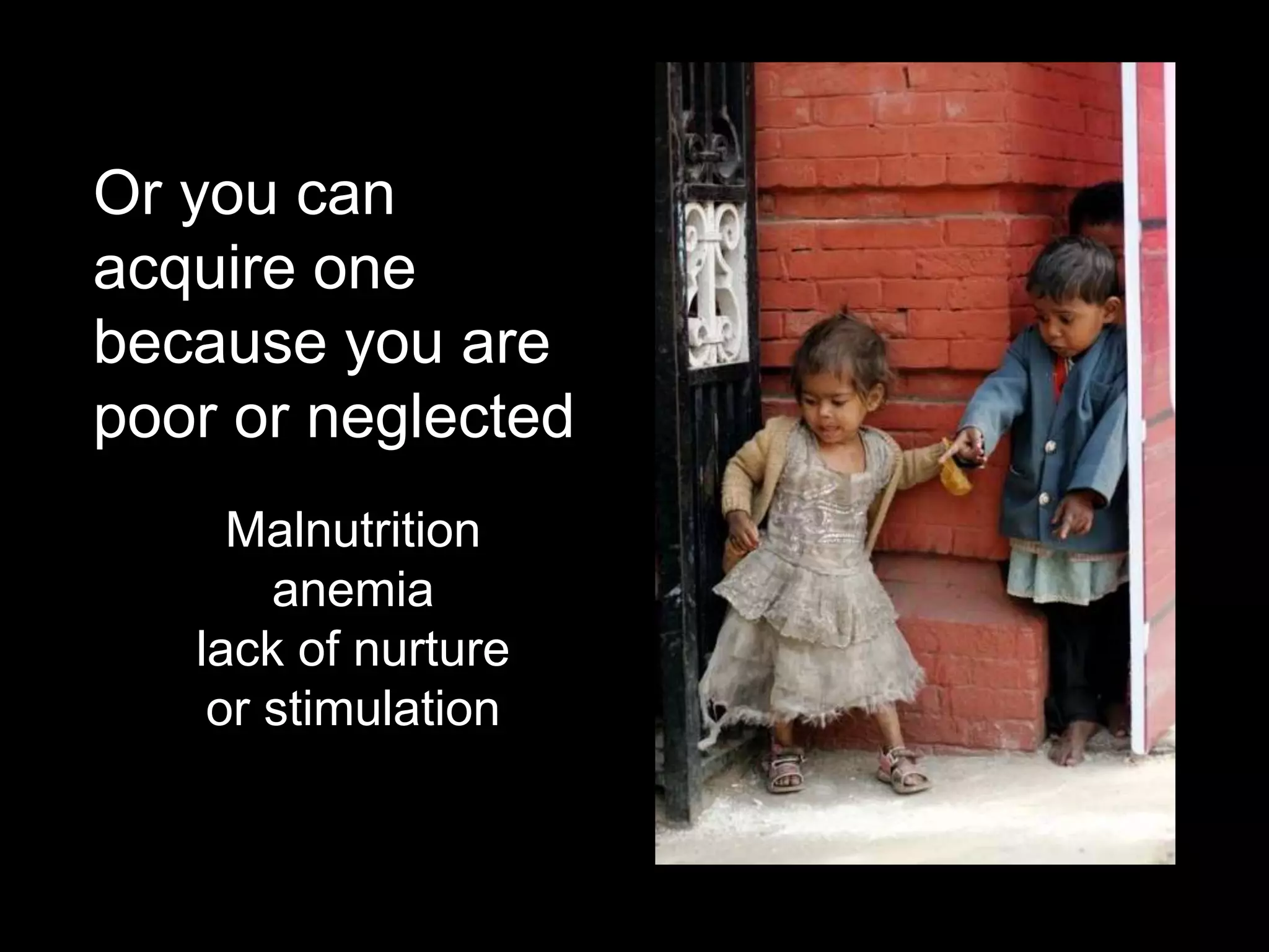 Or you can
acquire one
because you are
poor or neglected
Malnutrition
anemia
lack of nurture
or stimulation