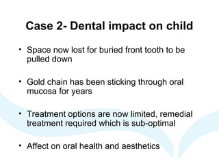 Case 2- Dental impact on child
• Space now lost for buried front tooth to be
pulled down
• Gold chain has been sticking through oral
mucosa for years
• Treatment options are now limited, remedial
treatment required which is sub-optimal
• Affect on oral health and aesthetics
 
