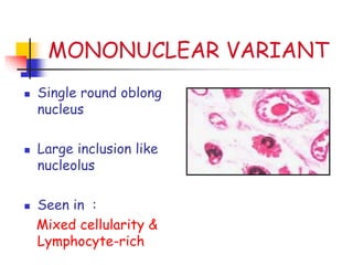 MONONUCLEAR VARIANT
 Single round oblong
nucleus
 Large inclusion like
nucleolus
 Seen in :
Mixed cellularity &
Lymphocyte-rich
 