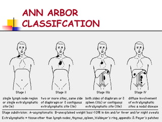 ANN ARBOR
CLASSIFCATION
 