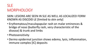 Lupus Rash Distribution AUTOIMMUNITY PART 2 SYSTEMIC LUPUS ERYTHEMATOSUS | PDF