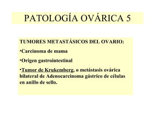 PATOLOGÍA OVÁRICA 5 TUMORES METASTÁSICOS DEL OVARIO: Carcinoma de mama Origen gastrointestinal Tumor de Krukemberg , o metástasis ovárica bilateral de Adenocarcinoma gástrico de células en anillo de sello. 