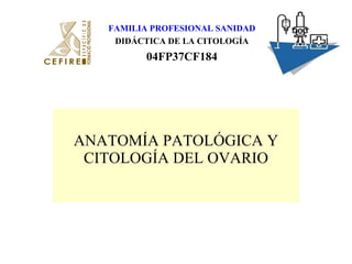 ANATOMÍA PATOLÓGICA Y CITOLOGÍA DEL OVARIO FAMILIA PROFESIONAL SANIDAD DIDÁCTICA DE LA CITOLOGÍA 04FP37CF184 
