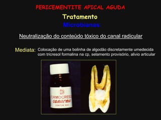 PERICEMENTITE APICAL AGUDA
Tratamento
Microbianas:
Neutralização do conteúdo tóxico do canal radicular
Mediata: Colocação de uma bolinha de algodão discretamente umedecida
com tricresol formalina na cp, selamento provisório, alivio articular
 