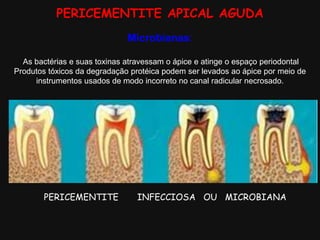 PERICEMENTITE APICAL AGUDA
Microbianas:
As bactérias e suas toxinas atravessam o ápice e atinge o espaço periodontal
Produtos tóxicos da degradação protéica podem ser levados ao ápice por meio de
instrumentos usados de modo incorreto no canal radicular necrosado.
.
PERICEMENTITE INFECCIOSA OU MICROBIANA
 