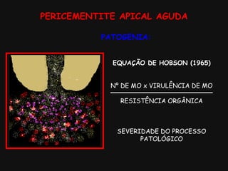 PERICEMENTITE APICAL AGUDA
EQUAÇÃO DE HOBSON (1965)
Nº DE MO x VIRULÊNCIA DE MO
RESISTÊNCIA ORGÂNICA
SEVERIDADE DO PROCESSO
PATOLÓGICO
PATOGENIA:
 