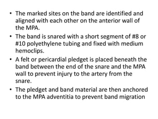 • The marked sites on the band are identified and
aligned with each other on the anterior wall of
the MPA.
• The band is snared with a short segment of #8 or
#10 polyethylene tubing and fixed with medium
hemoclips.
• A felt or pericardial pledget is placed beneath the
band between the end of the snare and the MPA
wall to prevent injury to the artery from the
snare.
• The pledget and band material are then anchored
to the MPA adventitia to prevent band migration
 