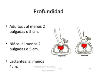 Profundidad
• Adultos : al menos 2
pulgadas o 5 cm.
• Niños: al menos 2
pulgadas o 5 cm.
• Lactantes: al menos
4cm. Instituto Superior Tecnológico
Cruz
Roja Ecuatoriana
100
 