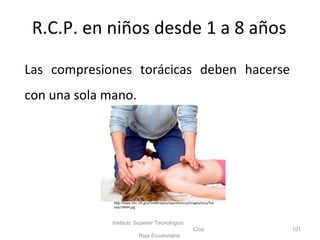 R.C.P. en niños desde 1 a 8 años
Las compresiones torácicas deben hacerse
con una sola mano.
Instituto Superior Tecnológico
Cruz
Roja Ecuatoriana
101
http://www.nlm.nih.gov/medlineplus/spanish/ency/images/ency/full
size/19644.jpg
 