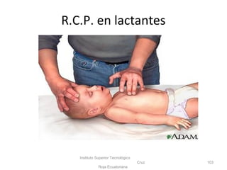 Instituto Superior Tecnológico
Cruz
Roja Ecuatoriana
103
R.C.P. en lactantes
 