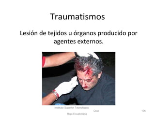 Lesión de tejidos u órganos producido por
agentes externos.
Instituto Superior Tecnológico
Cruz
Roja Ecuatoriana
106
Traumatismos
 
