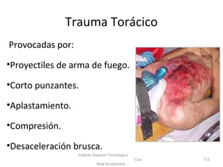 Trauma Torácico
Provocadas por:
•Proyectiles de arma de fuego.
•Corto punzantes.
•Aplastamiento.
•Compresión.
•Desaceleración brusca.
Instituto Superior Tecnológico
Cruz
Roja Ecuatoriana
112
 