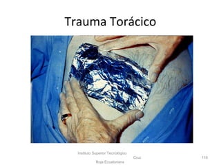 Instituto Superior Tecnológico
Cruz
Roja Ecuatoriana
116
Trauma Torácico
 