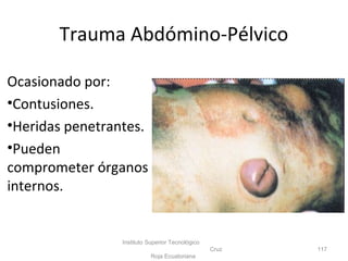 Trauma Abdómino-Pélvico
Ocasionado por:
•Contusiones.
•Heridas penetrantes.
•Pueden
comprometer órganos
internos.
Instituto Superior Tecnológico
Cruz
Roja Ecuatoriana
117
 