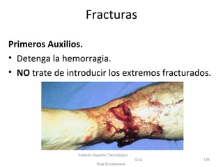 Primeros Auxilios.
• Detenga la hemorragia.
• NO trate de introducir los extremos fracturados.
Instituto Superior Tecnológico
Cruz
Roja Ecuatoriana
126
Fracturas
 