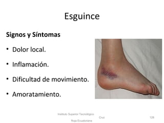 Signos y Síntomas
• Dolor local.
• Inflamación.
• Dificultad de movimiento.
• Amoratamiento.
Instituto Superior Tecnológico
Cruz
Roja Ecuatoriana
128
Esguince
 