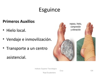 Primeros Auxilios
• Hielo local.
• Vendaje e inmovilización.
• Transporte a un centro
asistencial.
Instituto Superior Tecnológico
Cruz
Roja Ecuatoriana
129
Esguince
 