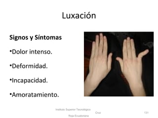 Signos y Síntomas
•Dolor intenso.
•Deformidad.
•Incapacidad.
•Amoratamiento.
Instituto Superior Tecnológico
Cruz
Roja Ecuatoriana
131
Luxación
 