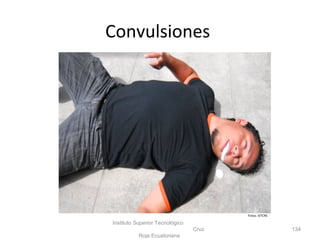 Convulsiones
Instituto Superior Tecnológico
Cruz
Roja Ecuatoriana
134
Fotos: ISTCRE
 