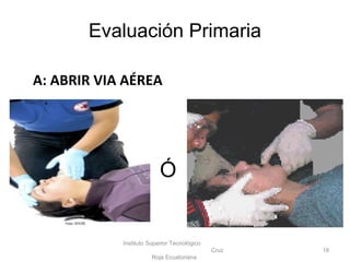 Instituto Superior Tecnológico
Cruz
Roja Ecuatoriana
18
Foto: ISTCRE
Ó
Evaluación Primaria
A: ABRIR VIA AÉREA
 