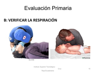 B: VERIFICAR LA RESPIRACIÓN
Instituto Superior Tecnológico
Cruz
Roja Ecuatoriana
19
Foto: ISTCRE
Evaluación Primaria
 