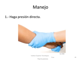 Manejo
1.- Haga presión directa.
Instituto Superior Tecnológico
Cruz
Roja Ecuatoriana
48
Foto: ISTCRE
 