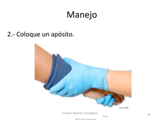 2.- Coloque un apósito.
Instituto Superior Tecnológico
Cruz
49
Manejo
Foto: ISTCRE
 