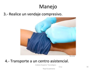 3.- Realice un vendaje compresivo.
Instituto Superior Tecnológico
Cruz
Roja Ecuatoriana
50
4.- Transporte a un centro asistencial.
Manejo
Foto: ISTCRE
 