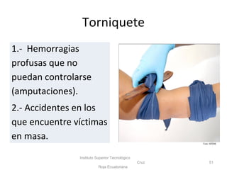Torniquete
Instituto Superior Tecnológico
Cruz
Roja Ecuatoriana
51
1.- Hemorragias
profusas que no
puedan controlarse
(amputaciones).
2.- Accidentes en los
que encuentre víctimas
en masa.
Foto: ISTCRE
 