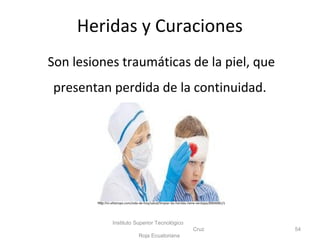Heridas y Curaciones
Son lesiones traumáticas de la piel, que
presentan perdida de la continuidad.
Instituto Superior Tecnológico
Cruz
Roja Ecuatoriana
54
http://m.eltiempo.com/vida-de-hoy/salud/limpiar-las-heridas-tiene-ventajas/8904081/1
 