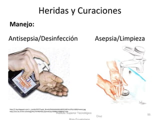 Manejo:
Antisepsia/Desinfección Asepsia/Limpieza
Instituto Superior Tecnológico
Cruz
55
http://1.bp.blogspot.com/-c_Lxm0x7tPY/TuyeV_8LmAI/AAAAAAAAKUM/k51BC5rLA7k/s1600/manos.jpg
http://ces.iisc.ernet.in/energy/HC270799/HDL/spanish/pc/r0080s/r0080s07.htm
Heridas y Curaciones
 