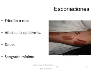 Escoriaciones
• Fricción o roce.
• Afecta a la epidermis.
• Dolor.
• Sangrado mínimo.
Instituto Superior Tecnológico
Cruz
Roja Ecuatoriana
57
http://piel-l.org/blog/archives/20597
 