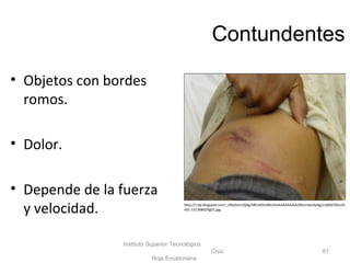 Contundentes
• Objetos con bordes
romos.
• Dolor.
• Depende de la fuerza
y velocidad.
Instituto Superior Tecnológico
Cruz
Roja Ecuatoriana
61
http://1.bp.blogspot.com/_c9tuZomzQAg/S8CoK0cvNkI/AAAAAAAAAds/8Snmwc9ydig/s1600/285v35
n01-13136802fig01.jpg
 