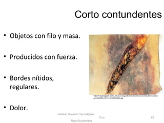 Corto contundentes
• Objetos con filo y masa.
• Producidos con fuerza.
• Bordes nítidos,
regulares.
• Dolor.
Instituto Superior Tecnológico
Cruz
Roja Ecuatoriana
62
http://1.bp.blogspot.com/_c9tuZomzQAg/S8CoK0cvNkI/AAAAAAAAAds/8Snmwc9ydi
g/s1600/285v35n01-13136802fig02.jpg
 