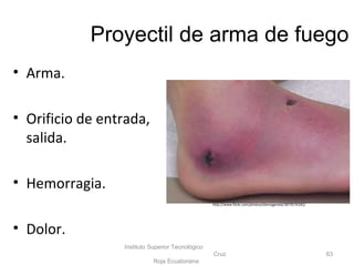 Proyectil de arma de fuego
• Arma.
• Orificio de entrada,
salida.
• Hemorragia.
• Dolor.
Instituto Superior Tecnológico
Cruz
Roja Ecuatoriana
63
http://www.flickr.com/photos/dannygerald/3879570181/
 