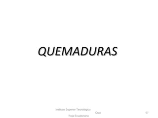Instituto Superior Tecnológico
Cruz
Roja Ecuatoriana
67
QUEMADURASQUEMADURAS
 