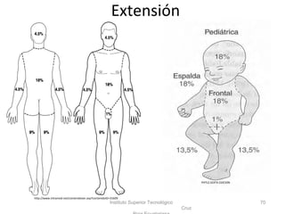 Extensión
Instituto Superior Tecnológico
Cruz
70
http://www.intramed.net/contenidover.asp?contenidoID=31609
PHTLS SEXTA EDICION
 