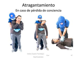 En caso de pérdida de conciencia
Instituto Superior Tecnológico
Cruz
Roja Ecuatoriana
87
Fotos: ISTCRE
Atragantamiento
 