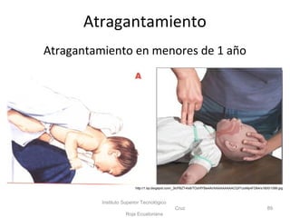 Atragantamiento en menores de 1 año
Instituto Superior Tecnológico
Cruz
Roja Ecuatoriana
89
http://1.bp.blogspot.com/_3lcPBZT4Is8/TOzHfYBe4AI/AAAAAAAAACQ/f1UoMp4FD64/s1600/1099.jpg
Atragantamiento
 