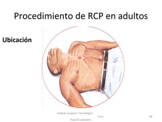 Procedimiento de RCP en adultos
Instituto Superior Tecnológico
Cruz
Roja Ecuatoriana
98
Ubicación
 