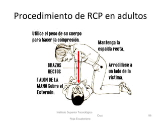 Instituto Superior Tecnológico
Cruz
Roja Ecuatoriana
99
Procedimiento de RCP en adultos
 