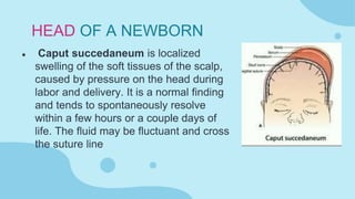 Immediate Newborn Care and Characteristics of a Newborn | PPTX
