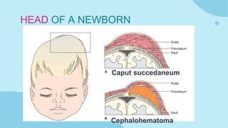 Immediate Newborn Care and Characteristics of a Newborn | PPTX