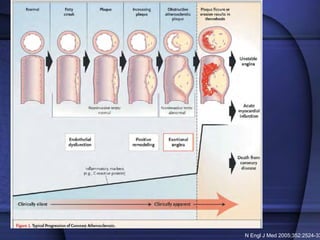 N Engl J Med 2005;352:2524-33
 