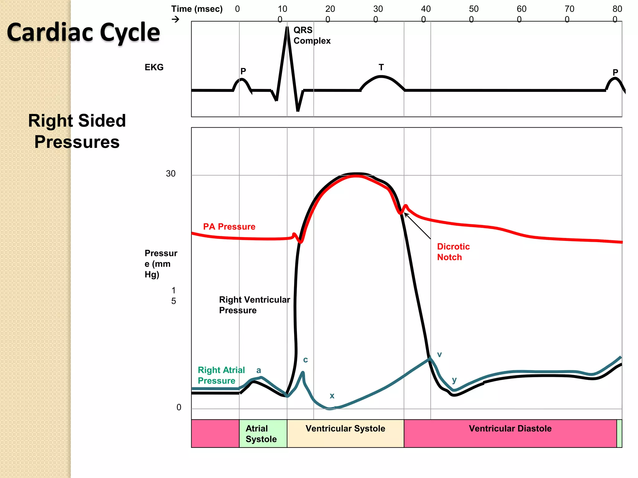 Pa catheter ctvac | PPTX