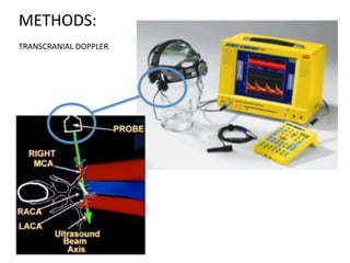 METHODS: 
TRANSCRANIAL 
DOPPLER 
 