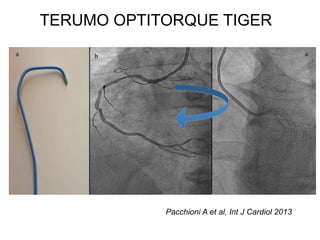 TERUMO OPTITORQUE TIGER 
Pacchioni A et al, Int J Cardiol 2013 
 