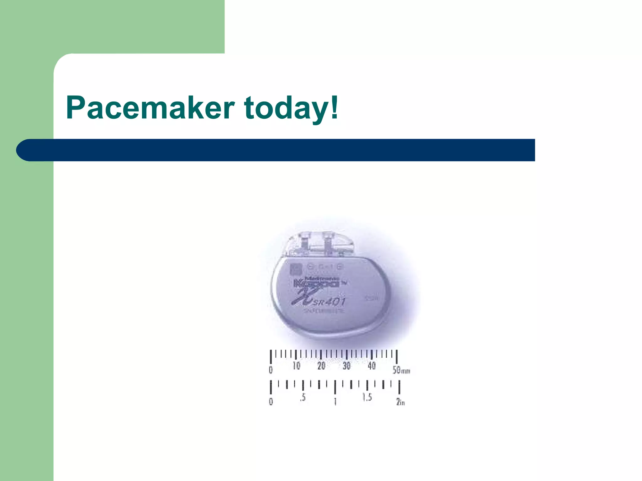 Pacemaker today! 